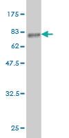 Anti-SPP1 Mouse Monoclonal Antibody [clone: 4H7]