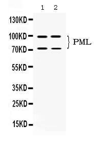 Anti-PML Rabbit Polyclonal Antibody