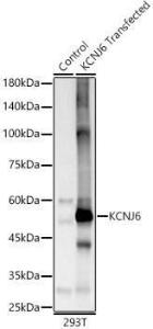 Western blot analysis of 293T-KCNJ6, using Anti-GIRK2 Antibody (A12423) at 1:1,000 dilution