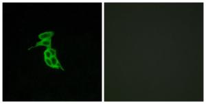 Immunofluorescence analysis of LOVO cells using Anti-GPR143 Antibody. The right hand panel represents a negative control, where the antibody was pre-incubated with the immunising peptide.