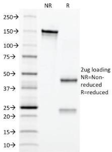 SDS-PAGE analysis of Anti-CD3 epsilon Antibody [C3e/2479] under non-reduced and reduced conditions; showing intact IgG and intact heavy and light chains, respectively. SDS-PAGE analysis confirms the integrity and purity of the antibody.