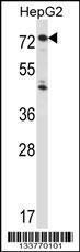 Anti-IL1R1 Rabbit Polyclonal Antibody (AP (Alkaline Phosphatase))