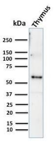 Western blot analysis of human thymus tissue lysate using Anti-Cytokeratin 10 Antibody [KRT10/844]