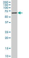 Anti-STK33 Mouse Monoclonal Antibody [clone: 1F10]