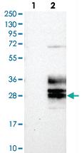 Anti-CLRN3 Rabbit Polyclonal Antibody