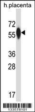 Anti-P4HA3 Rabbit Polyclonal Antibody (APC (Allophycocyanin))