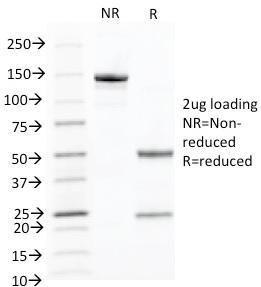 SDS-PAGE analysis of Anti-Cytokeratin 10 Antibody [KRT10/844] under non-reduced and reduced conditions; showing intact IgG and intact heavy and light chains, respectively. SDS-PAGE analysis confirms the integrity and purity of the antibody.