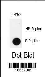 Anti-PDX1 Rabbit Polyclonal Antibody (HRP (Horseradish Peroxidase))