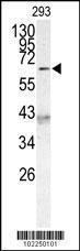 Anti-MLLT3 Rabbit Polyclonal Antibody (AP (Alkaline Phosphatase))