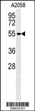 Anti-MMP14 Mouse Monoclonal Antibody [clone: 133CT15.10.5.1]