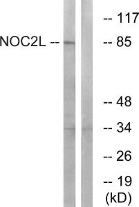 Western blot analysis of lysates from MCF-7 cells using Anti-NOC2L Antibody The right hand lane represents a negative control, where the antibody is blocked by the immunising peptide