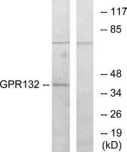 Western blot analysis of lysates from COS7 cells using Anti-GPR132 Antibody. The right hand lane represents a negative control, where the antibody is blocked by the immunising peptide