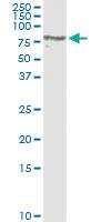 Anti-RTN4R Polyclonal Antibody Pair