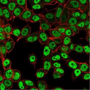 Anti-SMARCC1 antibody