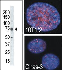 Anti-RPS6KA4 Rabbit Polyclonal Antibody