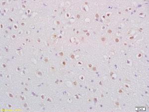 Anti-BDNF Rabbit Polyclonal Antibody