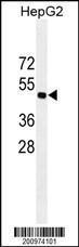 Anti-VEGFC Mouse Monoclonal Antibody [clone: 197CT7.3.4]