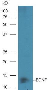 Anti-BDNF Rabbit Polyclonal Antibody