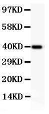 Anti-CD18 Polyclonal Antibody