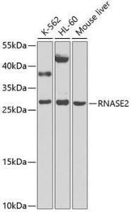 Antibody anti-RNASE2 100 µl