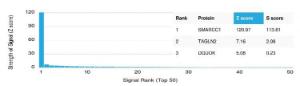 Anti-SMARCC1 antibody