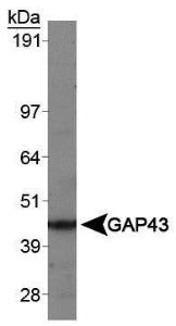 Anti-HSPD1 Rabbit Polyclonal Antibody