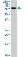 Anti-LIMK1 Mouse Monoclonal Antibody [clone: 1A8]