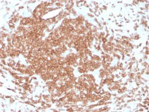 Immunohistochemical analysis of formalin-fixed, paraffin-embedded human tonsil using Anti-CD3 epsilon Antibody [rC3e/1308]