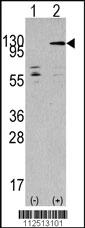 Anti-TAOK3 Rabbit Polyclonal Antibody