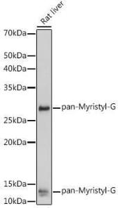 Western blot analysis of extracts of Rat liver, using Anti-pan myristoyl Glycine Antibody (A309647) at 1:500 dilution