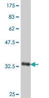 Anti-SLCO1B1 Mouse Polyclonal Antibody