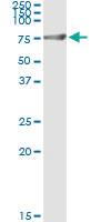 Anti-GPI Polyclonal Antibody Pair