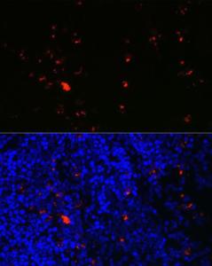 Antibody anti-RNASE2 100 µl