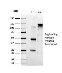 Anti-SMARCC1 antibody