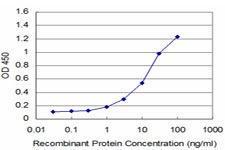 Anti-LIMK1 Mouse Monoclonal Antibody [clone: 2E9]