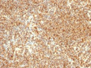 Anti-CD20 antibody