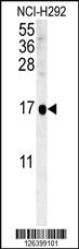 Anti-SIKE1 Rabbit Polyclonal Antibody