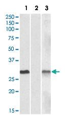 Anti-DYDC1 Goat Polyclonal Antibody