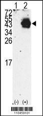 Anti-PDX1 Rabbit Polyclonal Antibody (Biotin)