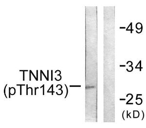 Anti-TNNI3