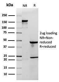 SDS-PAGE analysis of Anti-CD3 epsilon Antibody [rC3e/1308] under non-reduced and reduced conditions; showing intact IgG and intact heavy and light chains, respectively. SDS-PAGE analysis confirms the integrity and purity of the antibody.