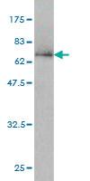 Anti-SPP1 Mouse Monoclonal Antibody [clone: 3E11]