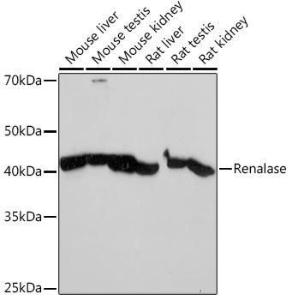 Western blot analysis of extracts of various cell lines, using Anti-Renalase Antibody [ARC2324] (A306987) at 1:1,000 dilution