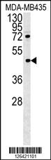 Anti-PYHIN1 Rabbit Polyclonal Antibody