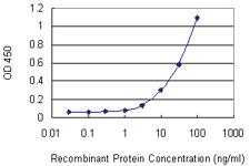 Anti-ITGAM Mouse Monoclonal Antibody [clone: 4E10]