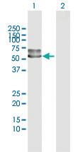 Anti-SERPINF2 Rabbit Polyclonal Antibody