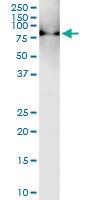 Anti-PIAS1 Rabbit Polyclonal Antibody