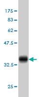 Anti-POLR3K Mouse Monoclonal Antibody [clone: 3F5]