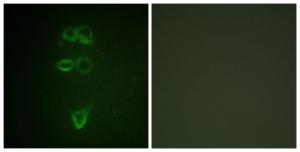 Immunofluorescence analysis of HepG2 cells using Anti-TIE2 (phospho Tyr1108) Antibody. The right hand panel represents a negative control, where the Antibody was pre-incubated with the immunising peptide