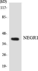 Western blot analysis of the lysates from COLO205 cells using Anti-NEGR1 Antibody